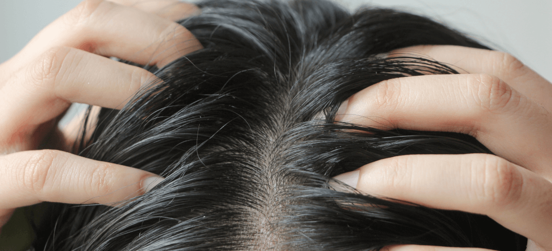 Como Cuidar do Cabelo Oleoso: Dicas e Rotina Diária